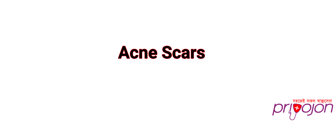 Acne Scars